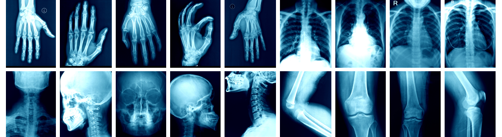 X-Ray services - St Luke's Oxford